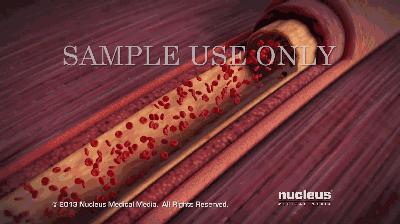 引起腹泻的原因科普,中西结合治疗功能性消化不良