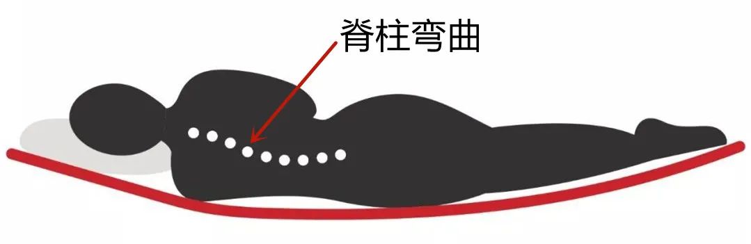 0-3个月婴儿要睡硬床还是软床,腰椎间盘突出睡软床还是硬床垫好