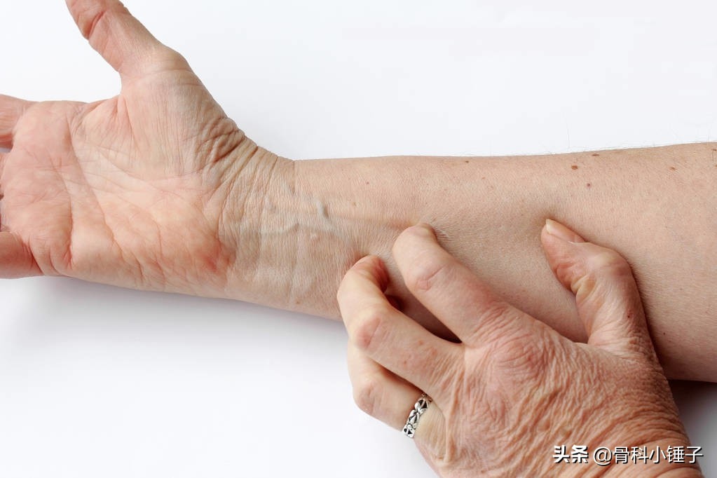 神经性皮炎的醋疗法,火针疗法视频神经性皮炎