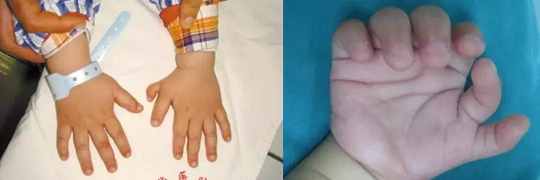 六指魔琴儿童,六指琴魔儿童版