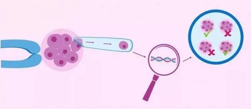 第一代第二代第三代试管婴儿,第一代第二代第三代试管婴儿费用