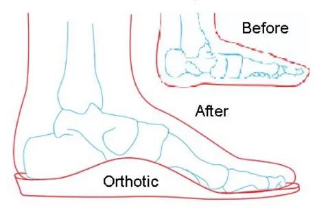咯嘣一声腰就疼了是怎么回事,扭到脚咯嘣一下是怎么回事