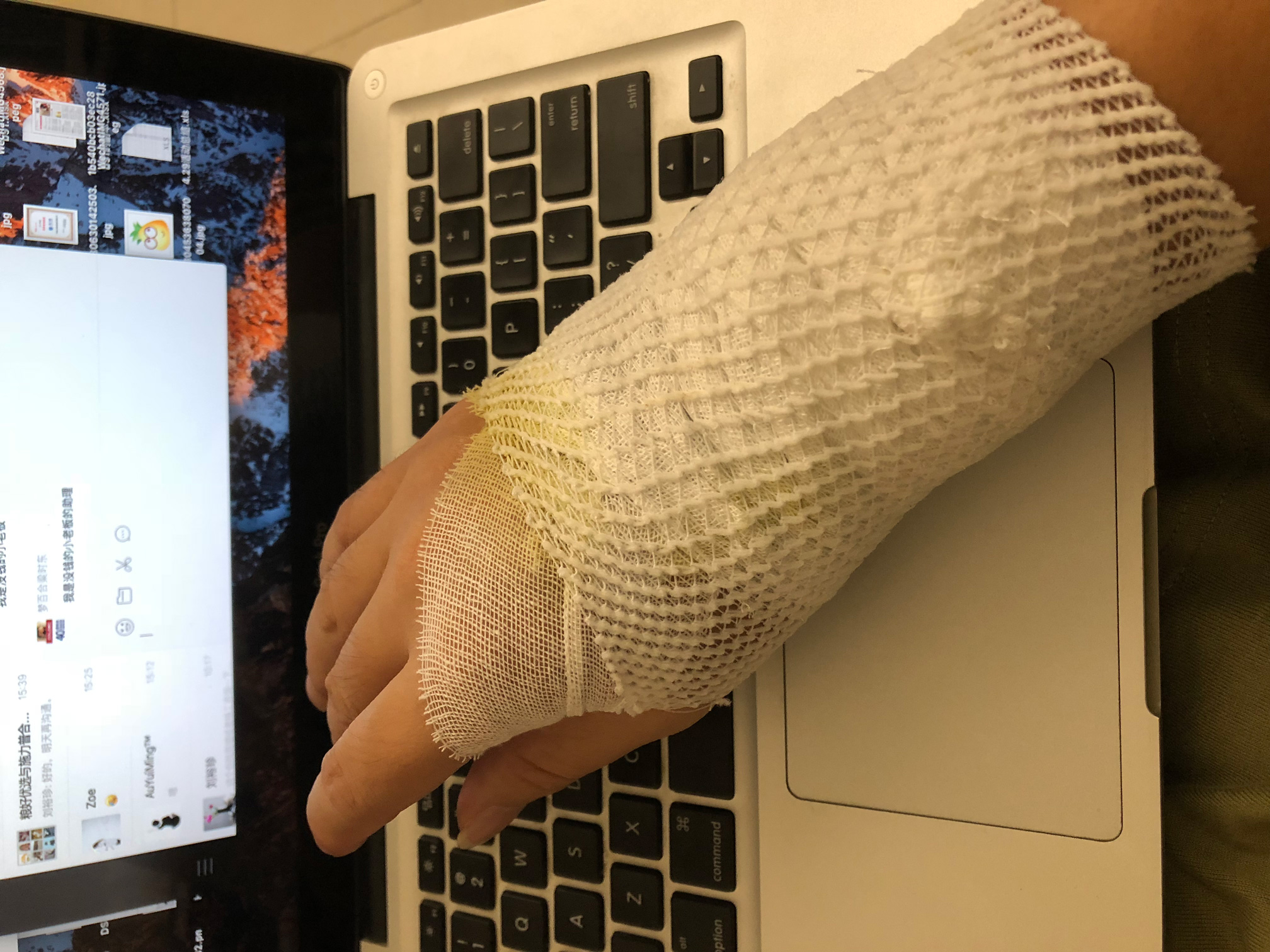 鼠标推荐防鼠标手,垂直鼠标能防鼠标手吗