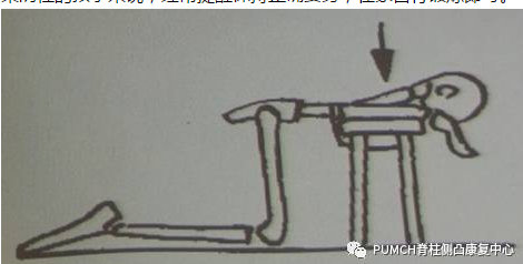 教你一招轻松搞定驼背,一秒纠正驼背超有效