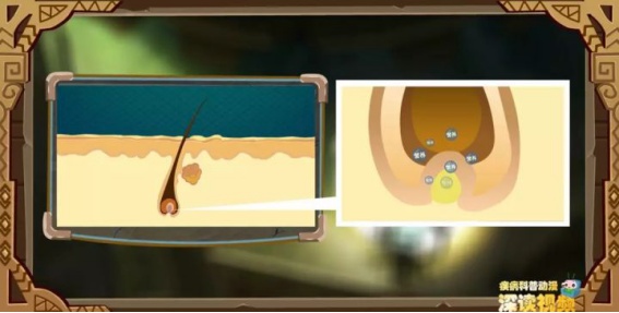 脱发的人注定要脱发,正常脱发与严重脱发的对比