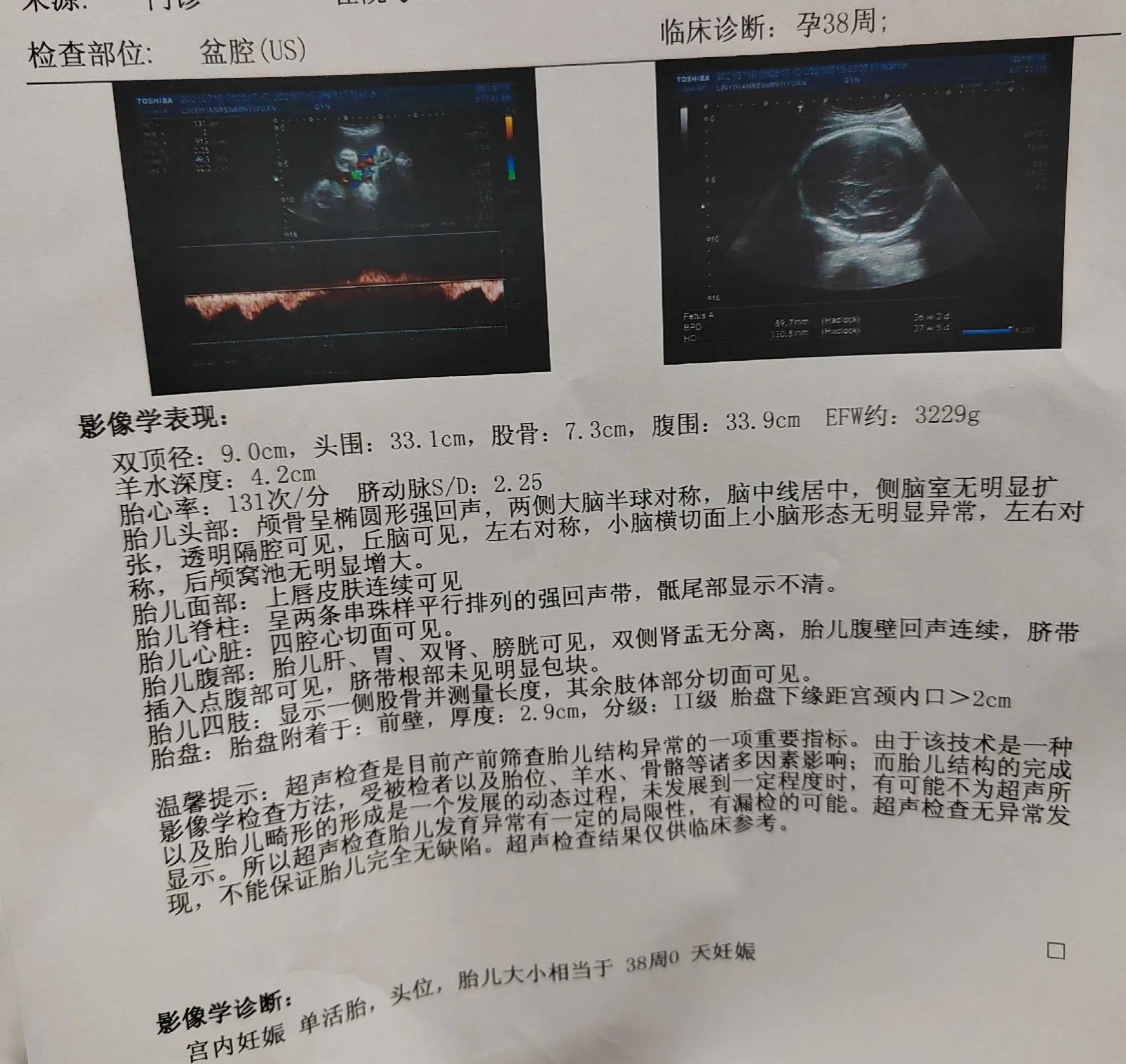 怀孕后当妈妈,顺利当妈妈