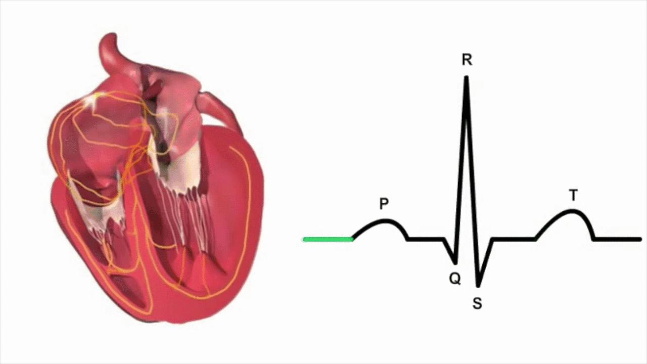 心脏停跳10秒是什么原因引起的,心跳慢心跳骤停怎么办
