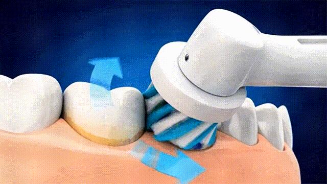 种植牙推荐电动牙刷,根据自己的牙选择电动牙刷