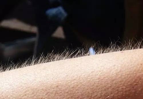 激光脱唇毛最真实测评,脱唇毛方法测评