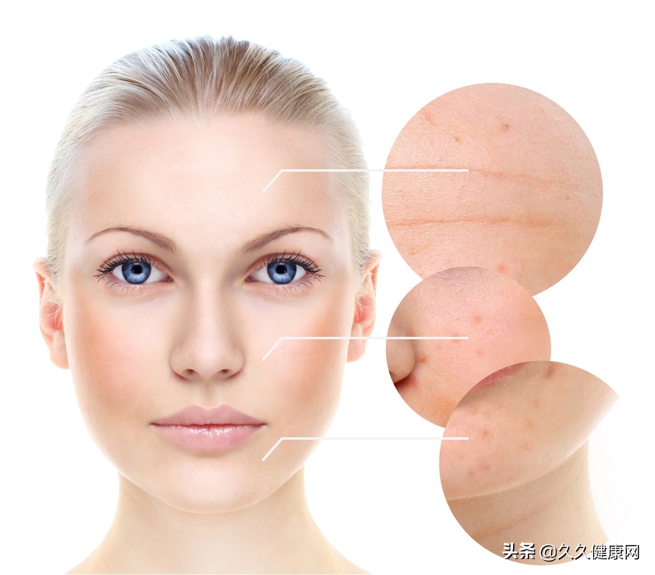 女生有唇毛怎么才能彻底去除,女生长唇毛怎么简单处理