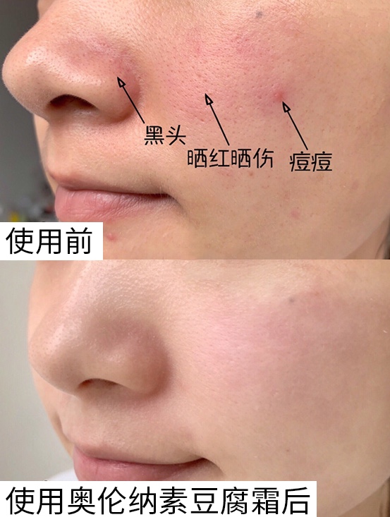 夏季面霜保湿不油腻推荐,清爽型夏季面霜学生平价