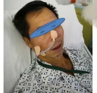 肝癌手术都需要插什么管子,肝癌术后为什么还有结节