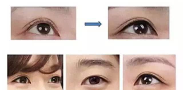 美瞳线针头粗的好还是细的好,美瞳线太细有必要加粗吗