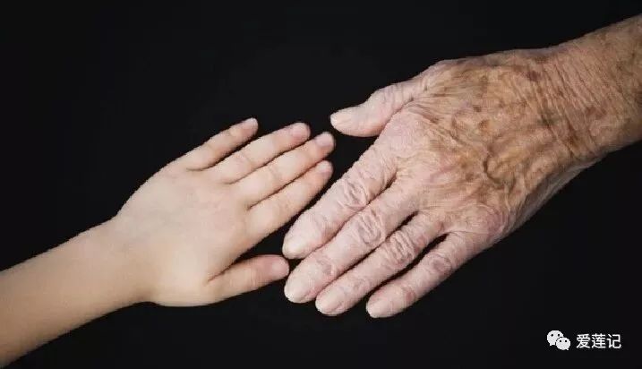 老人斑是不是一种病,老人斑是长寿吗