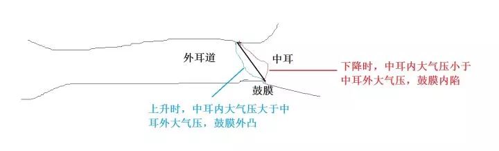 坐飞机耳朵堵了怎么快速通气妙招,坐飞机感觉耳朵里面跟堵住了一样