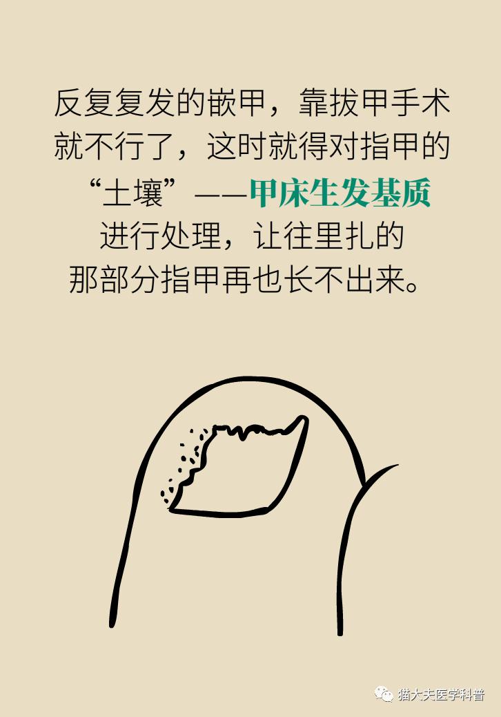脚趾甲往肉里长怎么治除根,脚趾甲长在肉里面治疗视频