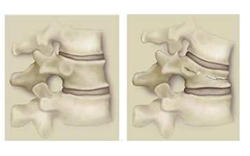 你知道吗腰痛的病因差别很大,腰痛何因