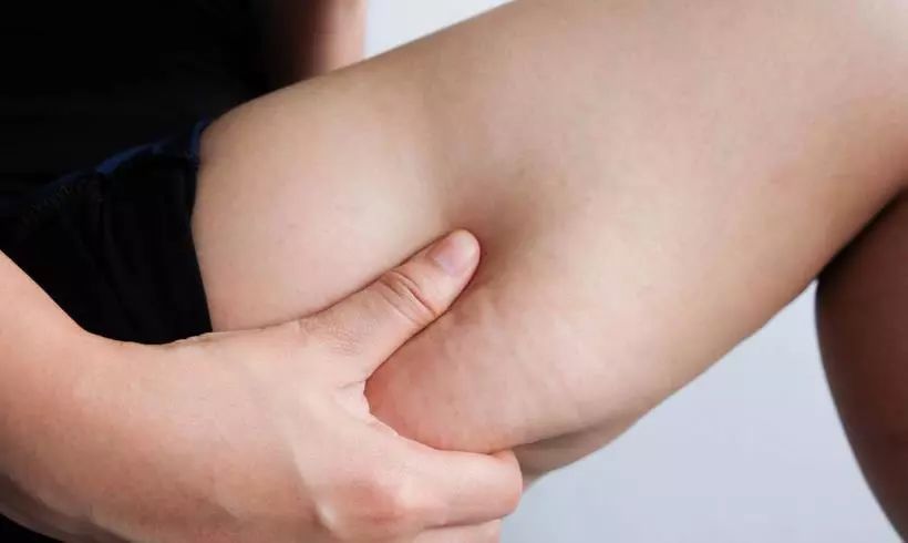 瘦下来橘皮会消失吗,橘皮组织肥胖怎么办