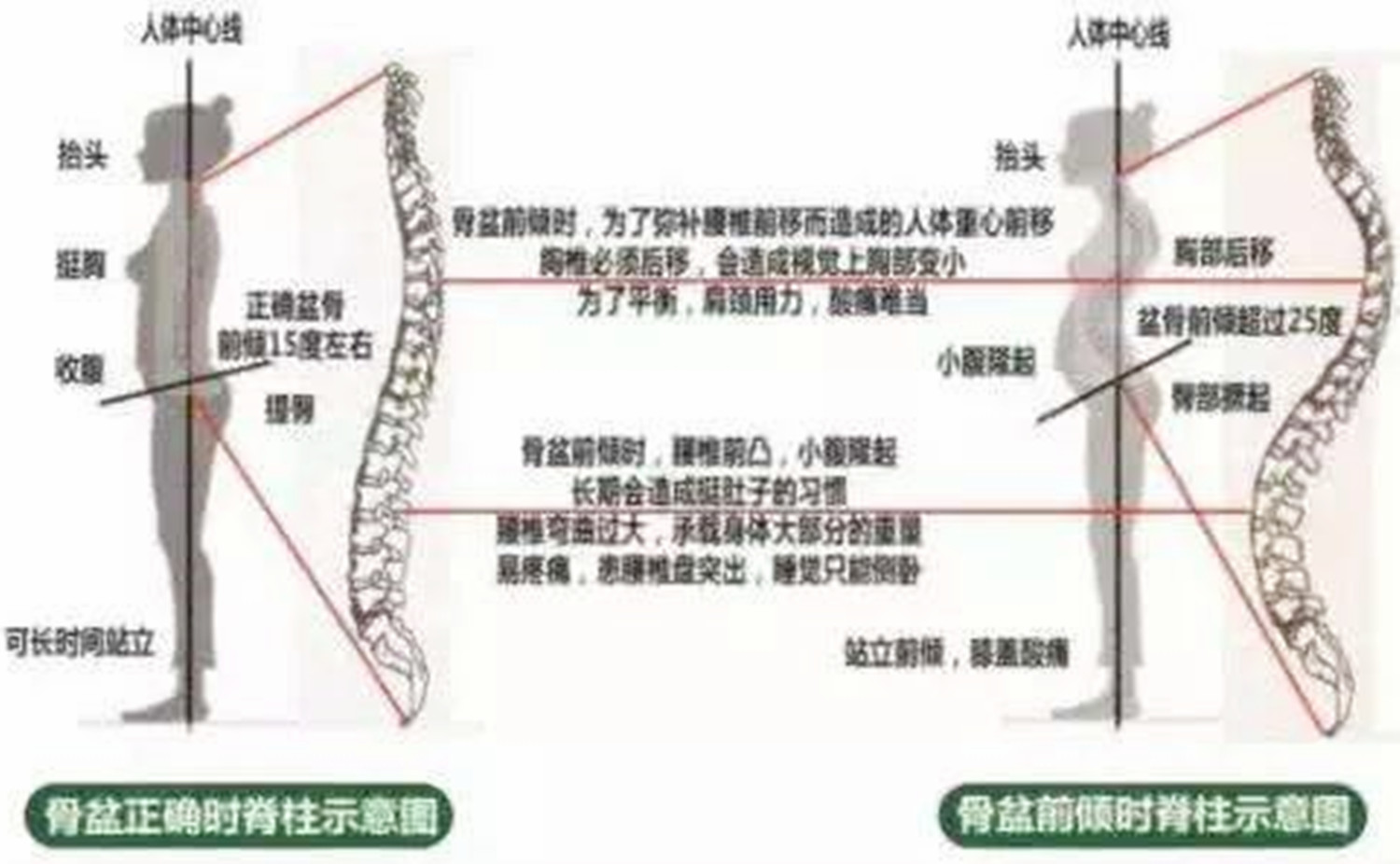 腰凳用错了勒住了宝宝,使用腰凳对大人的腰有影响吗