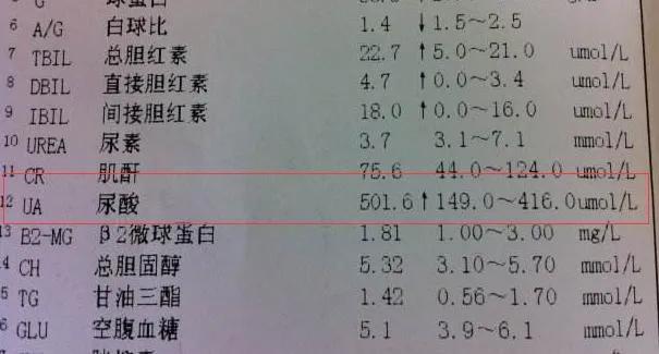 700尿酸属于什么等级,尿酸700多怎么调理