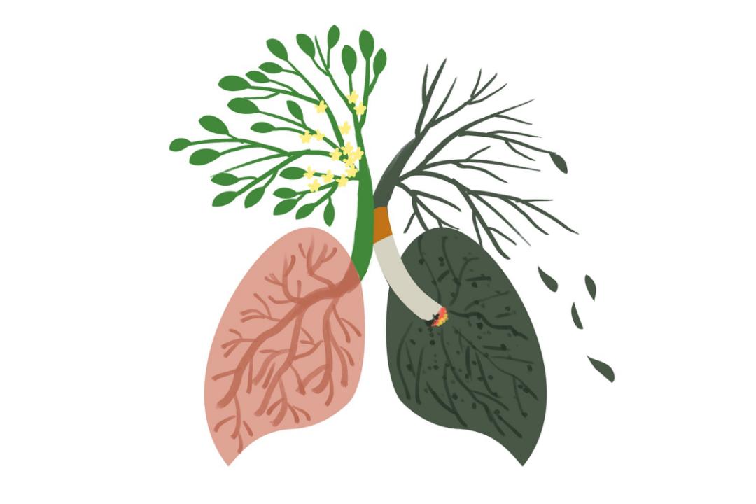 抗生素搞不定的慢性咽炎，老中医这样治好