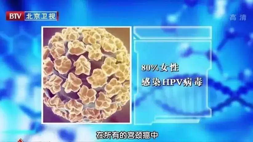 妇科病检查提前准备事项有哪些,常见妇科疾病的预防与自我检测