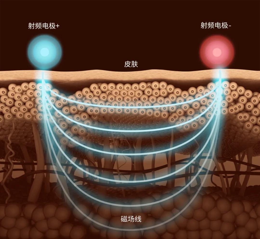 美容仪,可以对抗岁月痕迹?