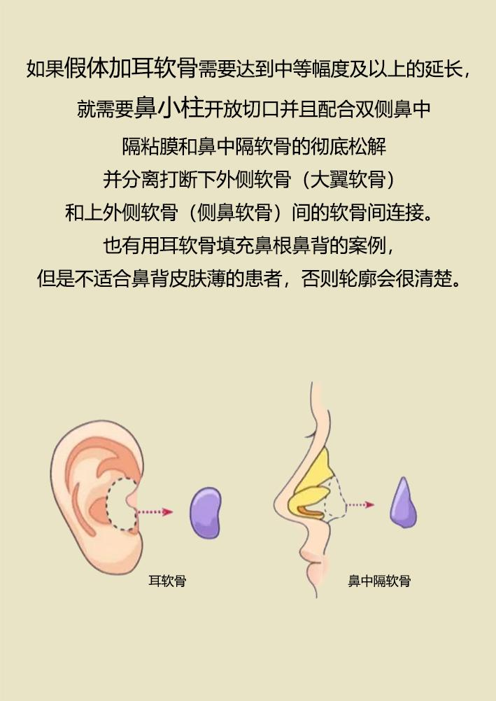 鼻整形之路,鼻整形拯救不完美鼻子的救星