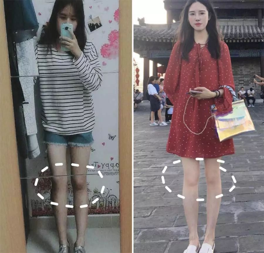 郑爽同款漫画腿不动刀也能get？吴昕的萝卜腿有救了