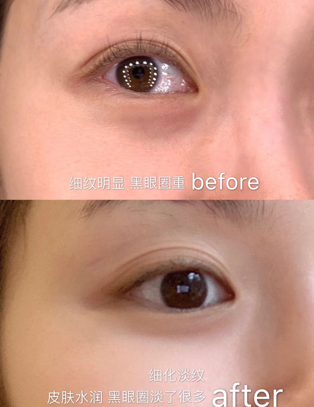 抗初老去眼袋黑眼圈的眼霜,抗老眼霜60岁推荐