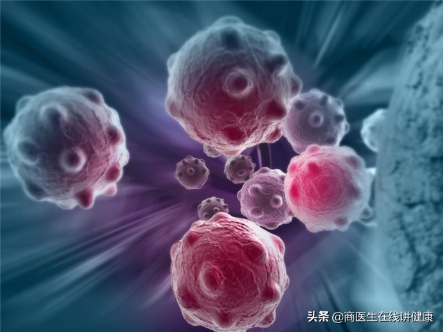 几个月内形成的浸润癌易复发么,浸润癌恶性