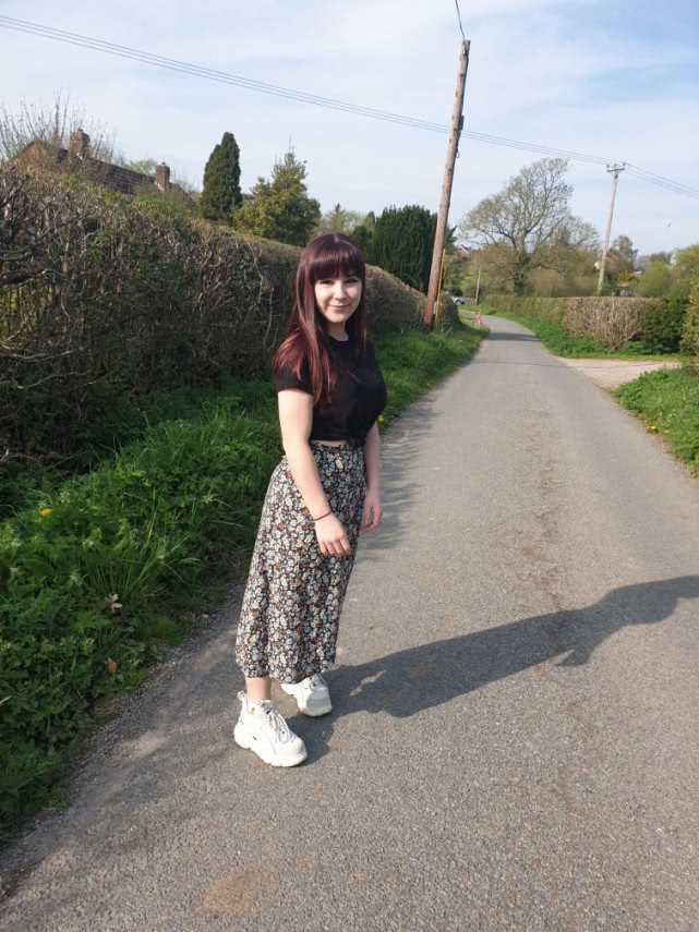 英国美女天生没有嗅觉什么都闻不到,称自己若能恢复闻臭鱼也愿意