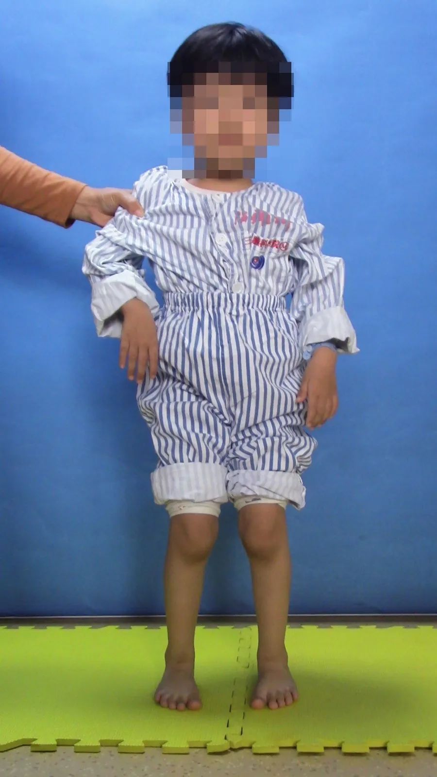 手术康复一体化,脑瘫康复训练10个方法图片