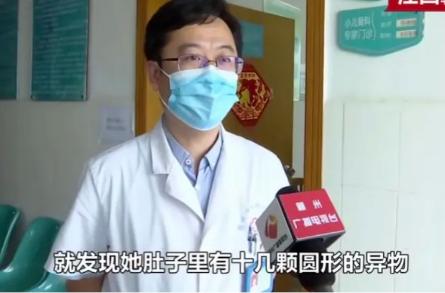 四岁小男孩切除150cm小肠,小孩子吃完饭剧烈运动急性肠梗阻