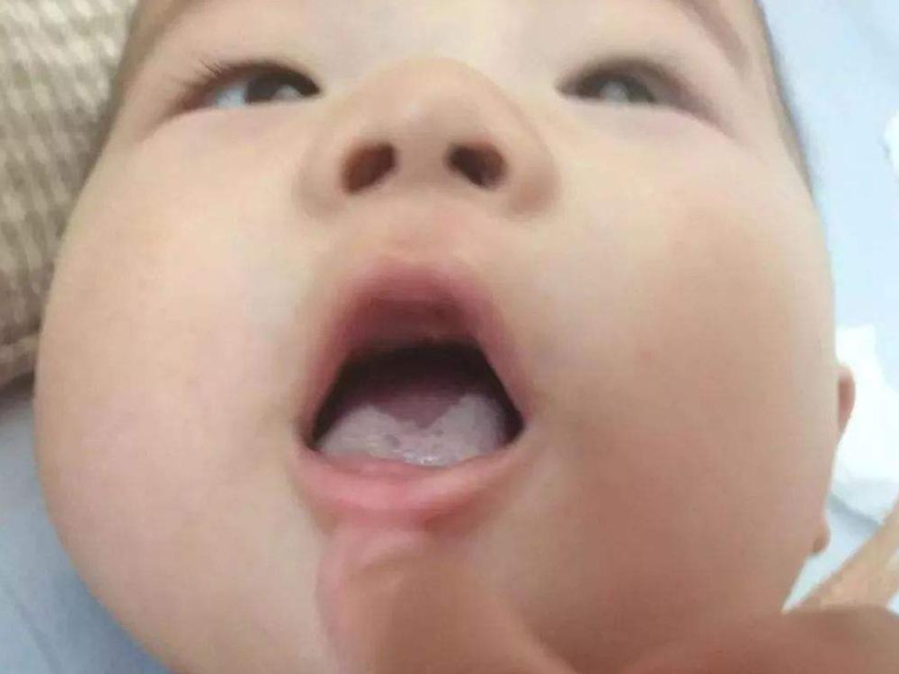 宝宝舌苔发白的原因及处理方法,宝宝舌苔发白是怎么回事要怎么办
