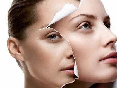 面部拉皮手术的后遗症有哪些,做脸部拉皮手术有什么后遗症