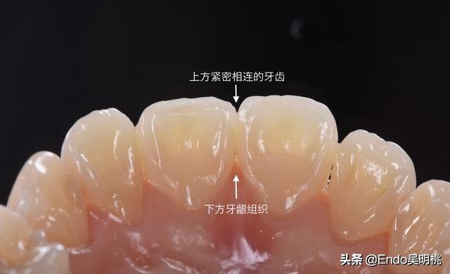 雾里看花墙布,雾里看花找枯枝