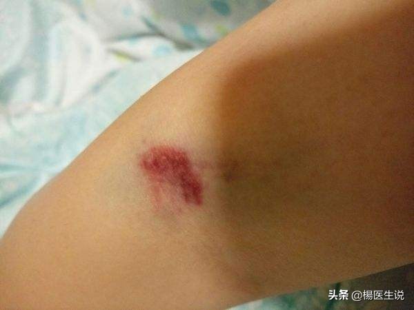 检验科趣事视频,检验科抽血搞笑视频