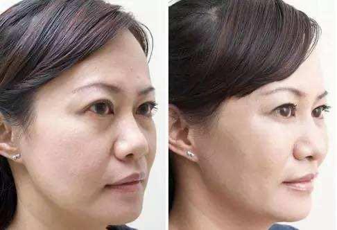 20岁少女一夜变成老太婆,妙龄少女一夜间变成老太太后续