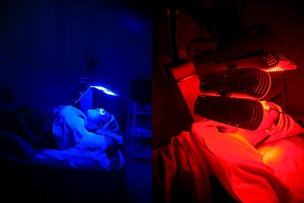 皮肤屏障受损为什么脸特别红,脸皮肤屏障受损严重怎么办