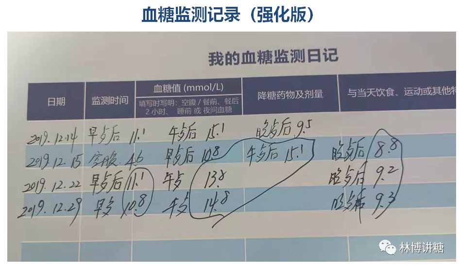 肾移植后血糖升高是什么原因,肾移植后并发糖尿病怎么办