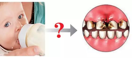 一岁孩子门牙奶瓶龋怎么办,两岁宝宝牙齿有奶瓶龋