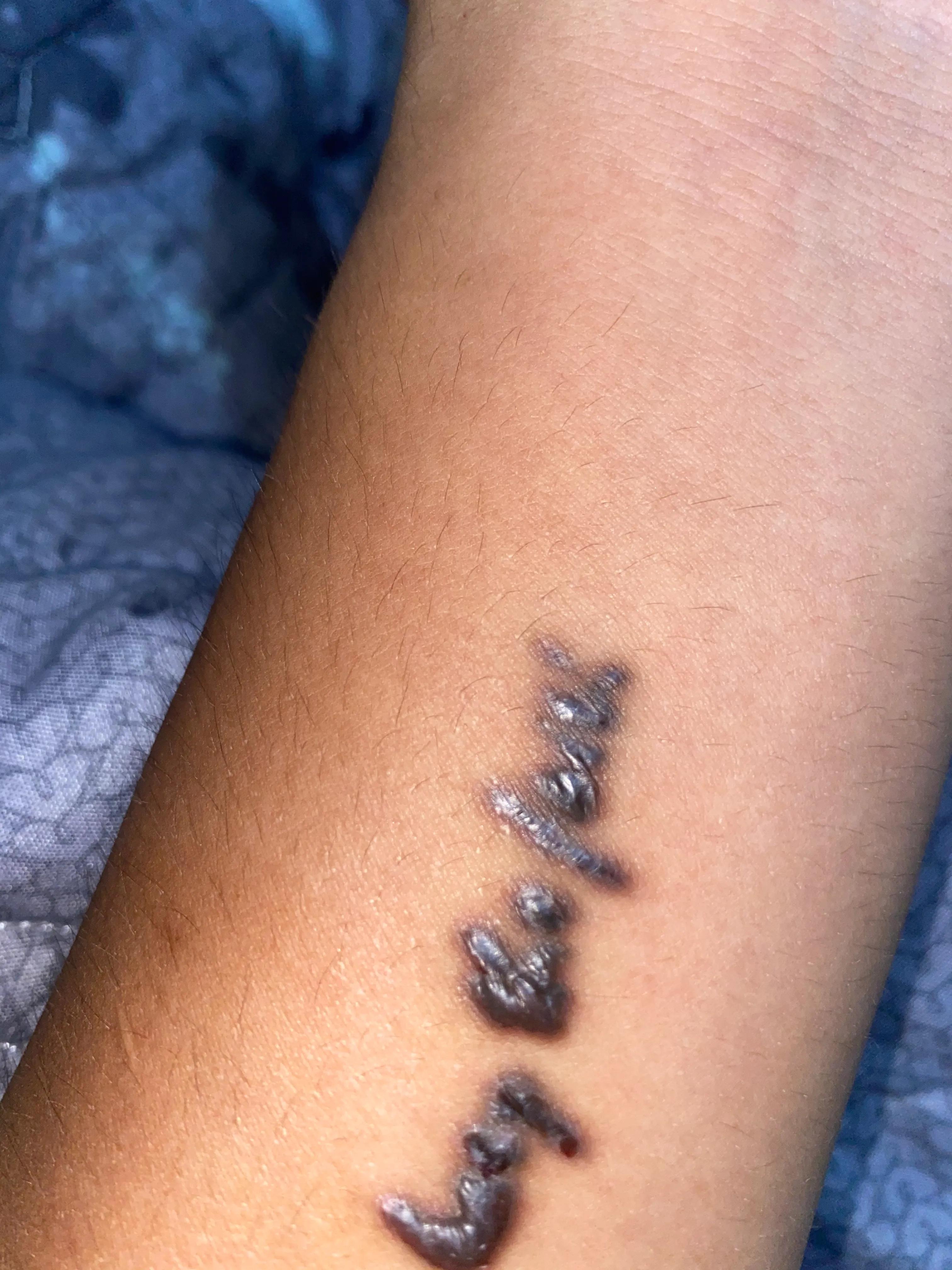 纹身洗干净后的图片,纹绣祛除膏真的能洗掉纹身吗