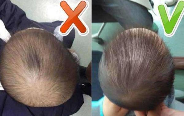 5个月宝宝后脑勺睡平了怎么纠正,5个月宝宝后脑勺扁平怎么办