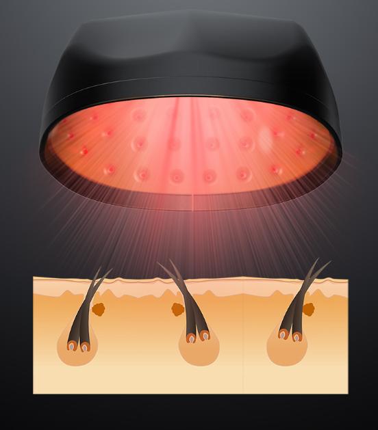 可思美激光生发帽真的有用吗,双十一种草美妆