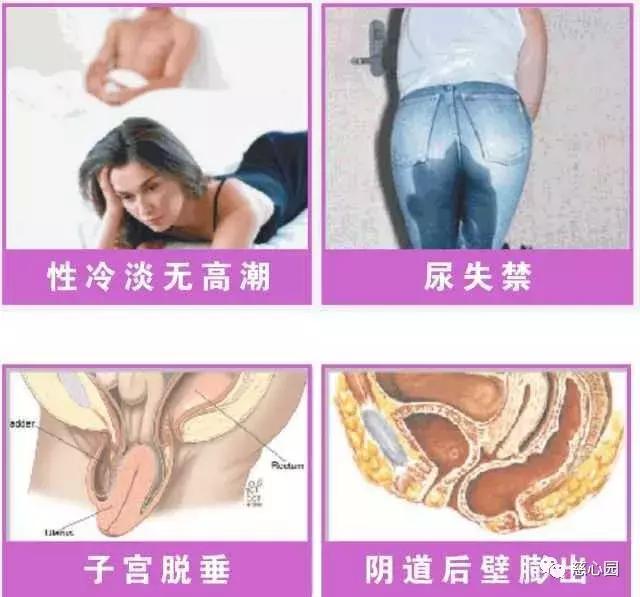 如何修复盆底肌漏尿,盆底肌修复主要修复什么