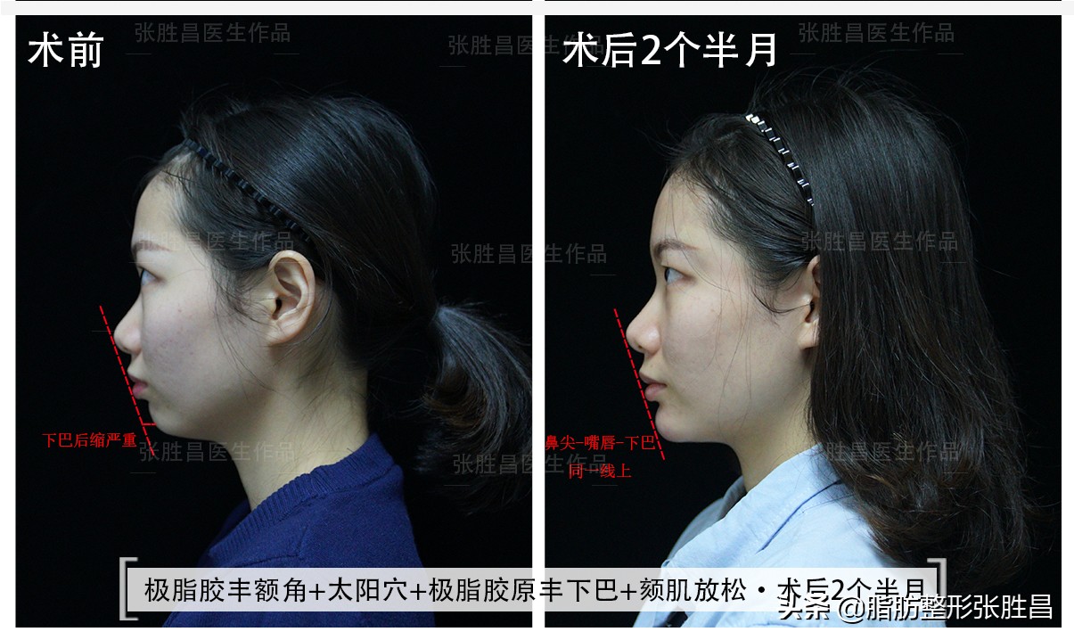 好看下巴的标准,好看的下巴的标准