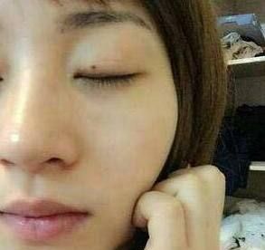 什么牌子老年斑的专用药膏见效快,老年斑的专用药膏