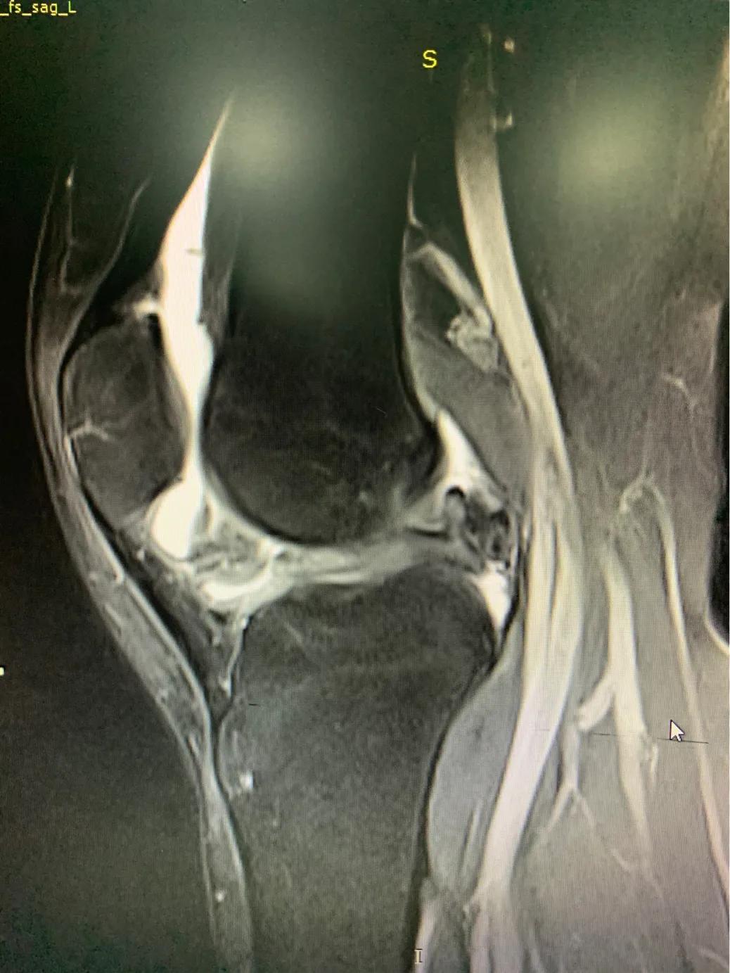 下蹲是按住好还是切换好,下蹲正确与错误对比图