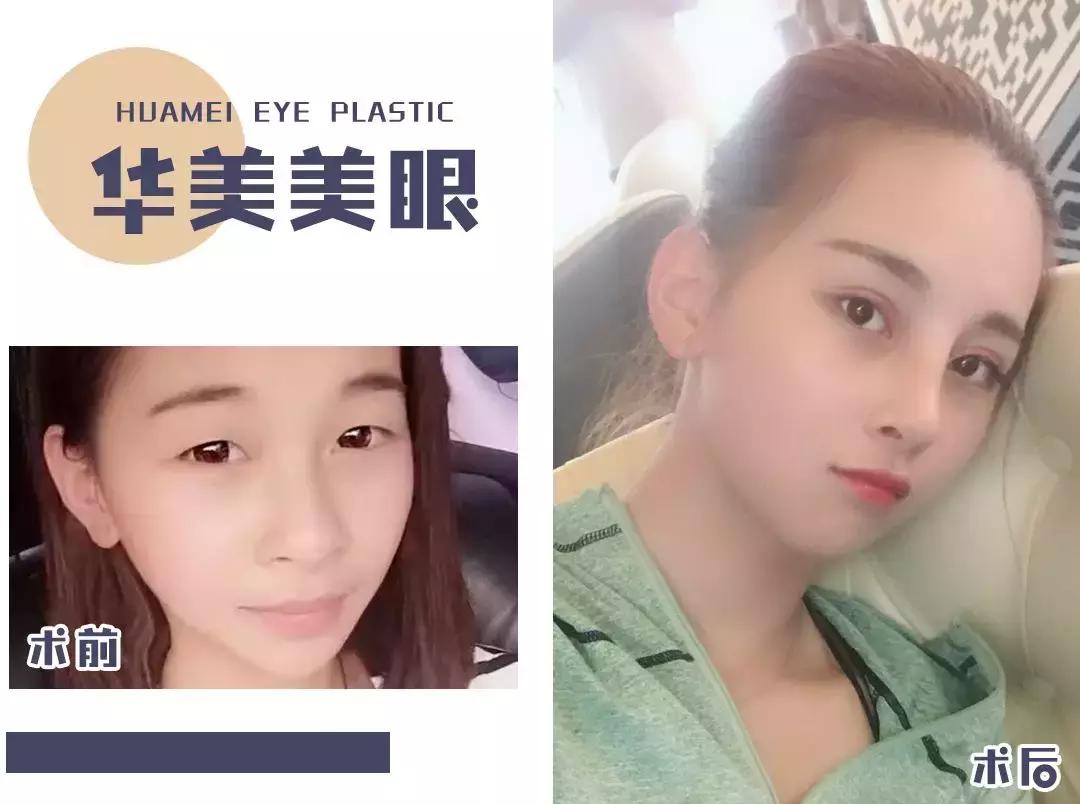 8.8元带你追李现!汕头女孩终于实现1折“变脸”